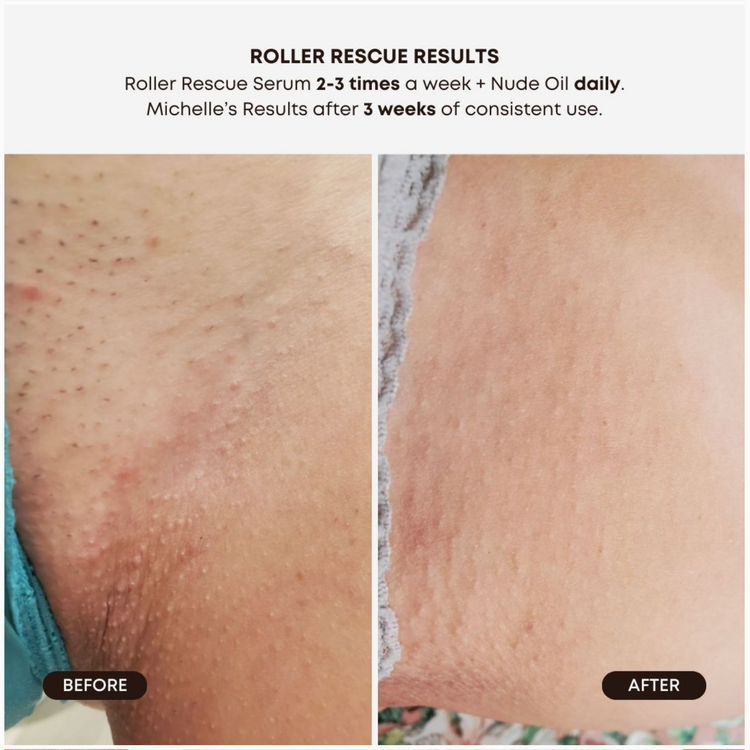 Bushbalm Roller Soothing Serum