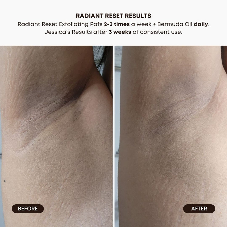 Bushbalm Radiant Reset Exfoliating Toner Pads